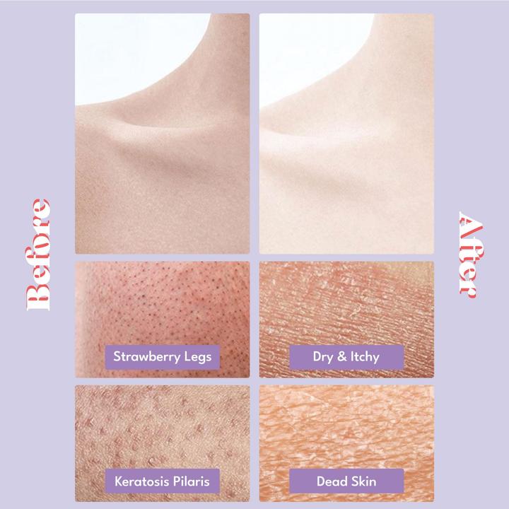 Produktbild Toi:L Gentle Touch Bubble Peeling Body Pad (200 ml)
