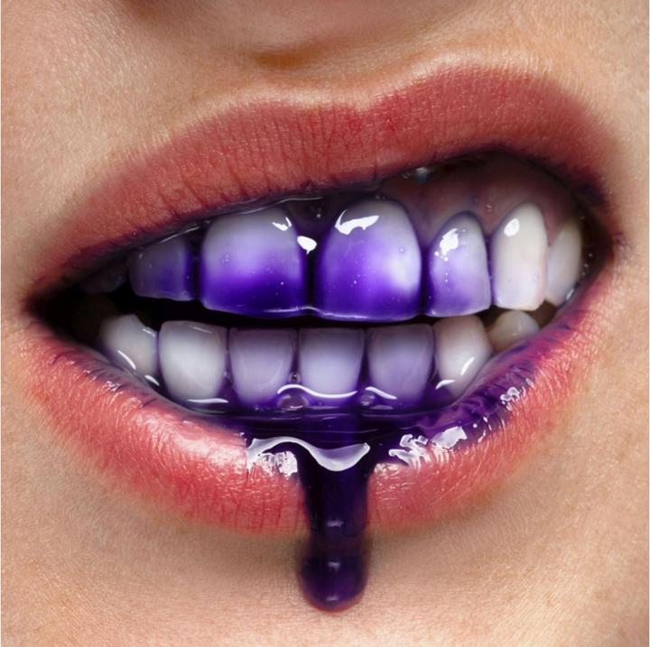 Produktbild SmilePen Instasmile (30 ml, Kit)
