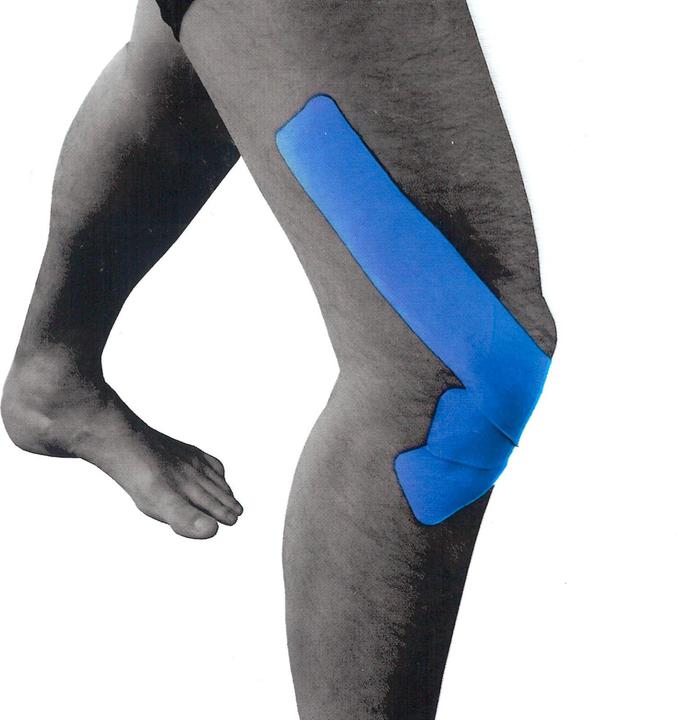 Image du produit Luxtri Ruban adhésif thérapeutique 3 bandes prédécoupées pour Genou 25x5cm Tape de sport bleu (0.25 m)