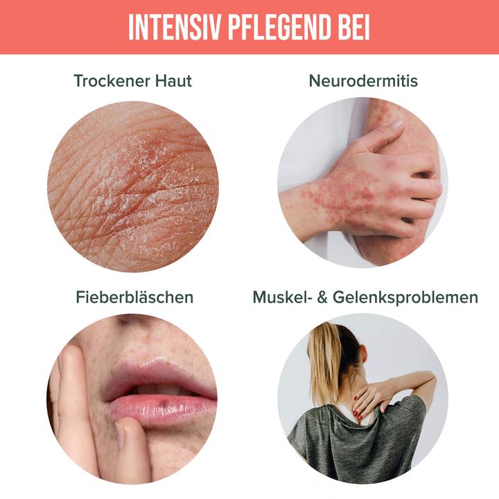 Produktbild Hempions CBD Repair Balm (Körpercreme, 50 ml)