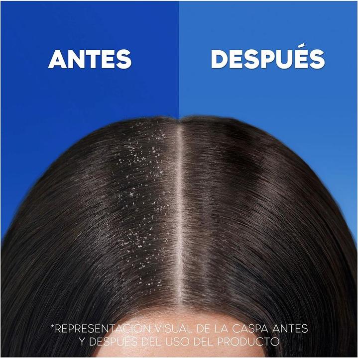 Produktbild H&S Anti-Dandruff & Anti-Hair Loss Shampoo for Men 1000ml (1000 ml, Flüssiges Shampoo)