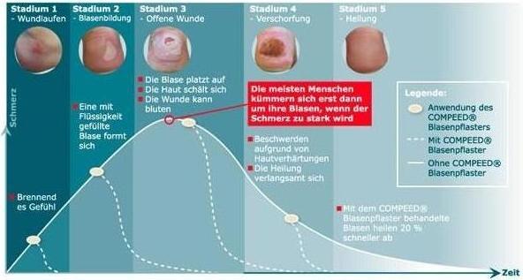 Actual product image Compeed Blister plaster Small (6 x)