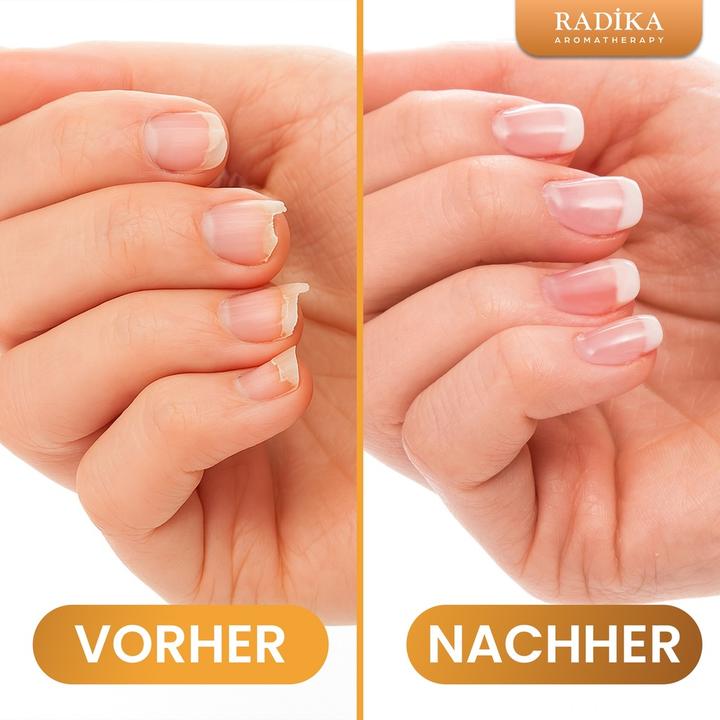 Produktbild Radika Nagelöle, Nagelpflege, Handcreme, 100% Rein, BIO, natürlich, 10 ml (10 ml)
