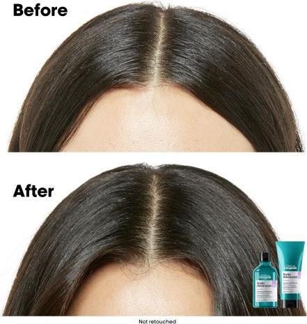 Produktbild L'Oréal Professionnel Serie Expert Scalp Advanced Anti-Discomfort Dermo-Regulator Refill (500 ml, Flüssiges Shampoo)