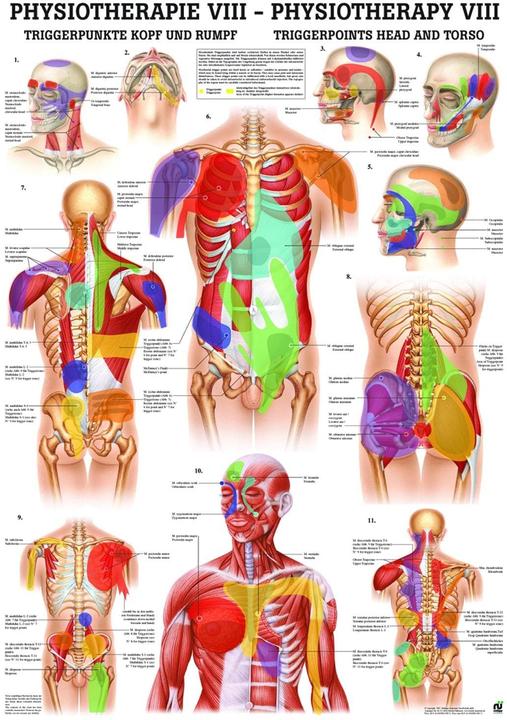 Produktbild Rüdiger Anatomische Lehrtafel Triggerpunkte Kopf & Rumpf 50 x 70 cm (7 x 7 x 50 cm)