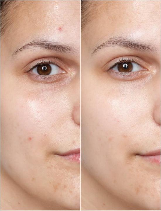 Produktbild Babor DOCTOR - Power Serum Ampoules Retinol 0.3% (14 ml)