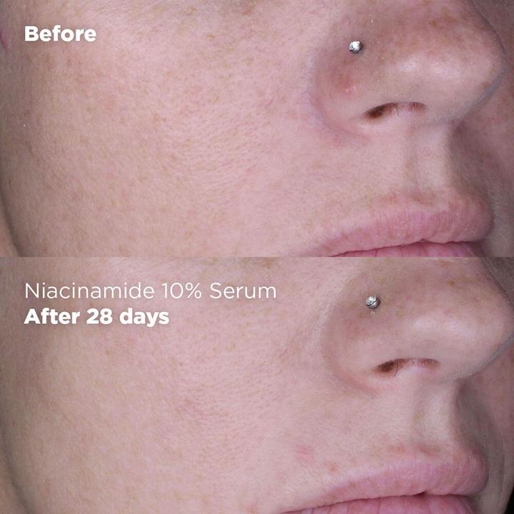 Produktbild Skin Republic Niacinamid 10% + Zink 1% Serum (30 ml)